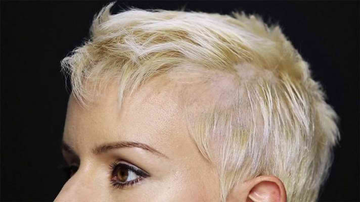 Rezultate Toppik inainte-dupa - femei