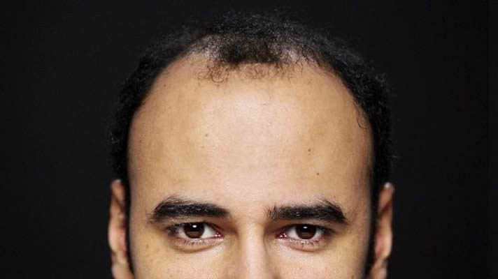 Rezultate Toppik inainte-dupa - barbati