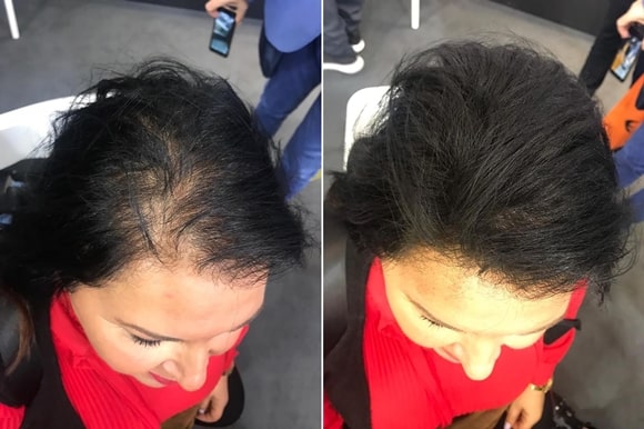 Rezultate clienti Toppik - femei