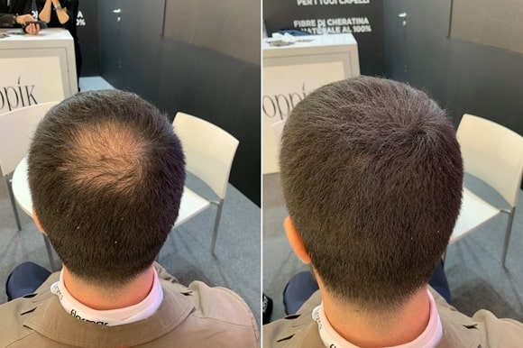 Rezultate clienti Toppik - barbati