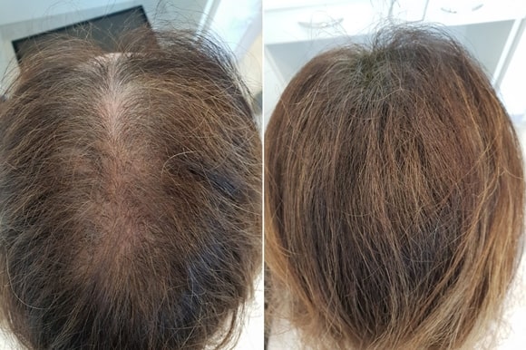 Rezultate clienti Toppik - femei