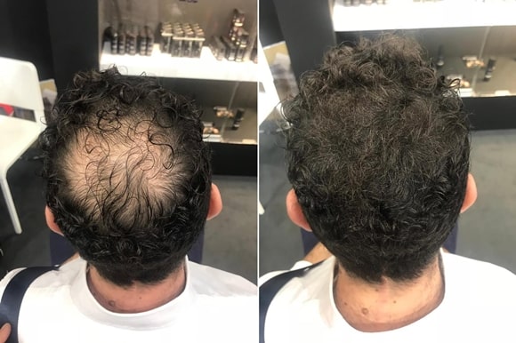 Rezultate clienti Toppik - barbati