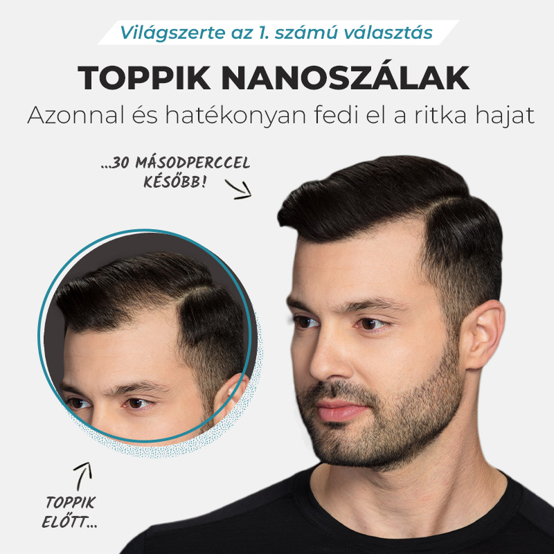 BLOG_promoToppik_mobile