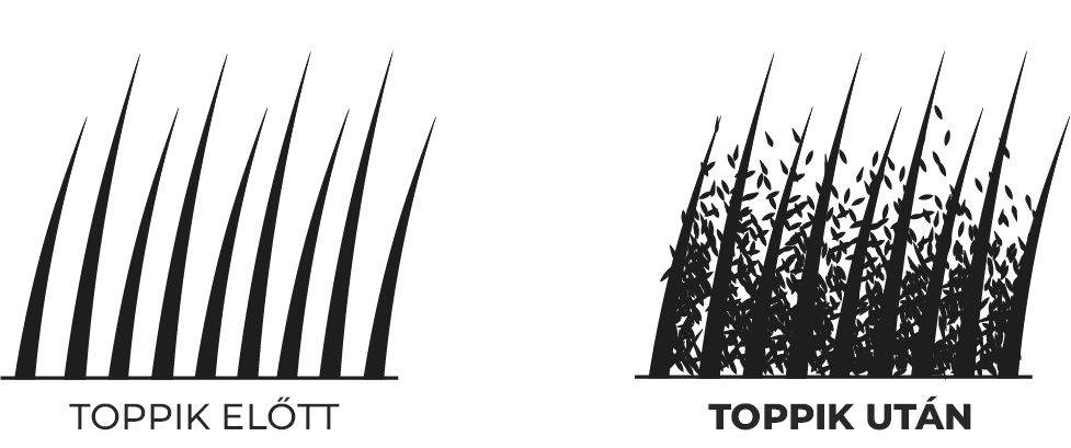 Firele de păr înainte/după aplicarea nanofibrelor Toppik.